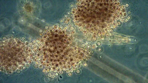 Microcystis, eine Gattung der Cyanobacterien, unter dem Mikroskop.