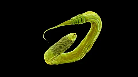 Mikroskopische Ansicht eines grünen Parasiten auf schwarzem Hintergrund.