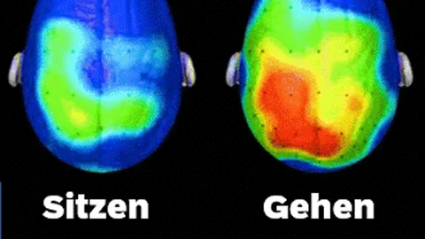 zwei gehirne im hirnscan mit unterschiedlichen farben