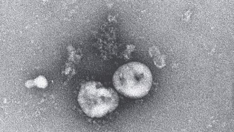 Virus