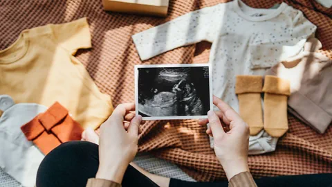 Eine Frau hält ein Ultraschallbild in der Hand, im Hintergrund sind Babykleider zu sehen.