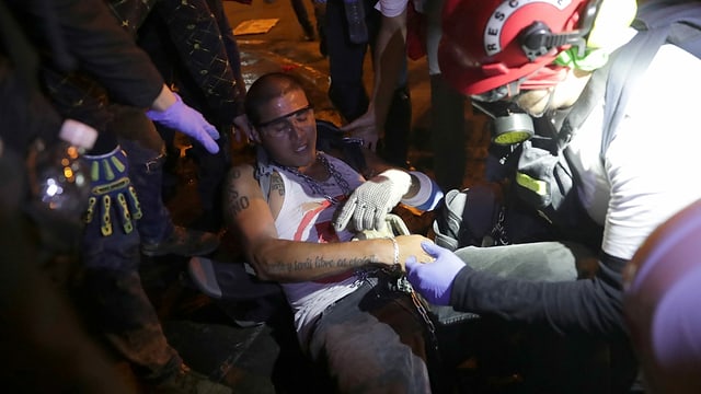 An injured protester can be seen in Lima.