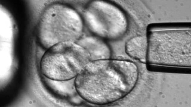 Eine Zelle wird von einem menschlichen Embryo entfernt, um embionalen Stammzellen für die Forschung zu gewinnen.