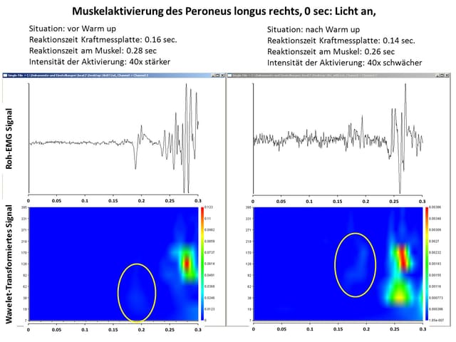 Unterschiede der Muskelaktivität vor und nach dem Warm-up