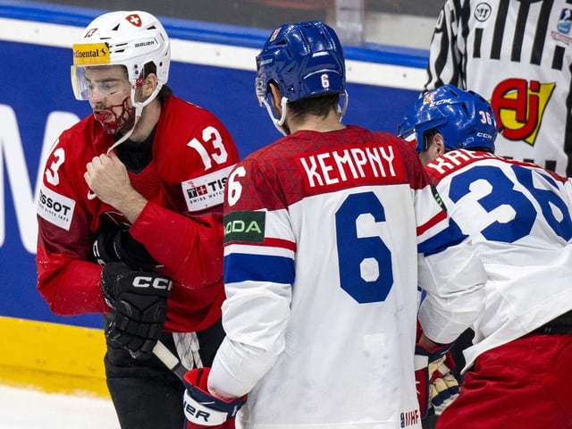 Nico Hischier mit blutüberströmtem Gesicht