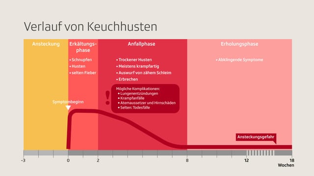 Der zeitliche Verlauf von Keuchhusten.