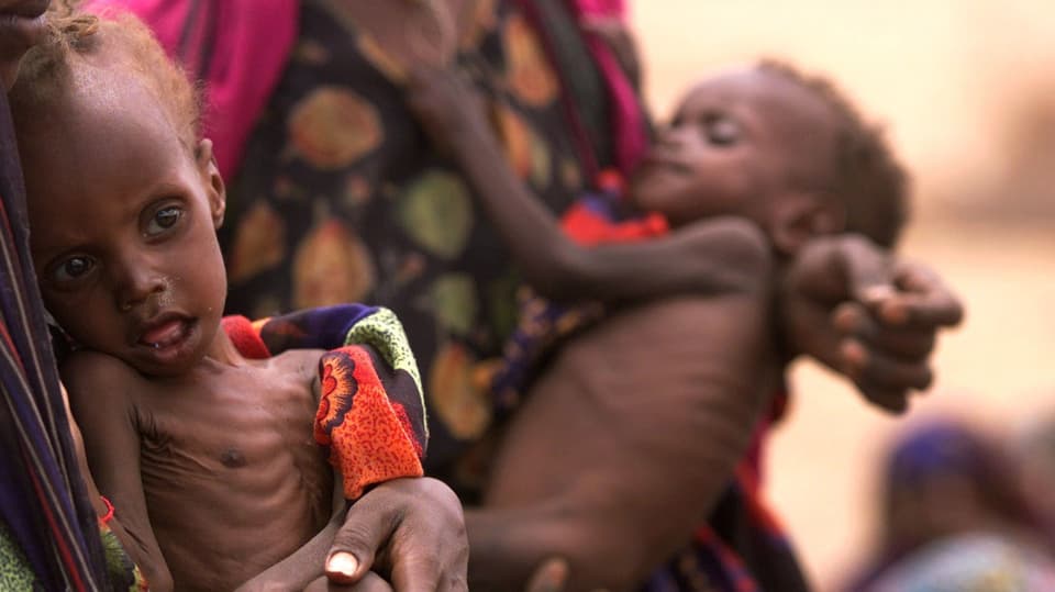 Unterernährte Kinder in Äthiopien