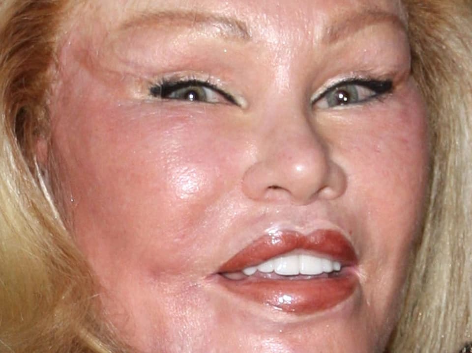 Eine Portrait-Aufnahme von Jocelyn Wildenstein, bei der die operativen Eingriffe klar sichtbar sind