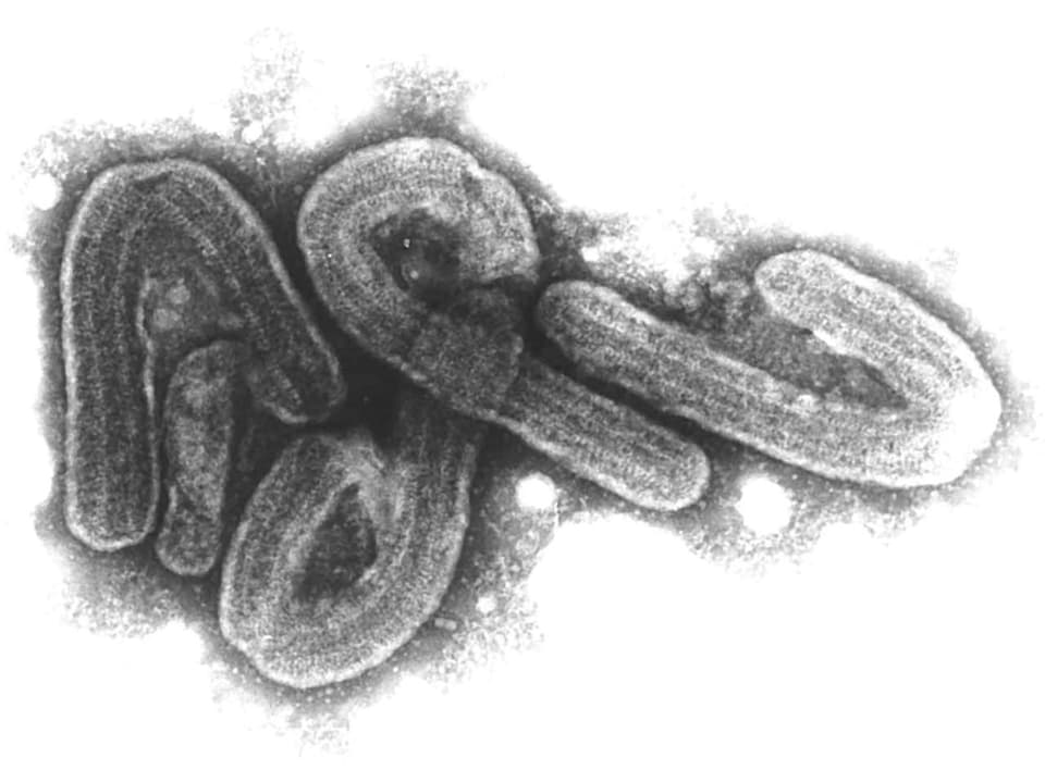 Elektronenmikroskop-Aufnahme eines Virus.