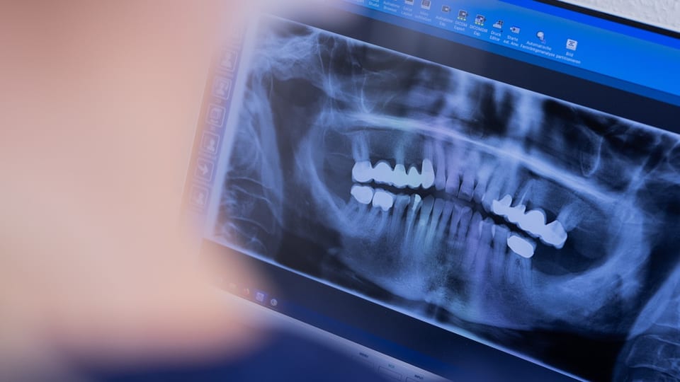 Bild eines dentalen Röntgens auf einem Computermonitor.